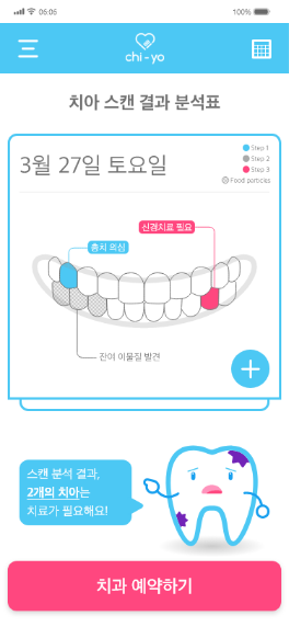 치요 스캔리포트페이지